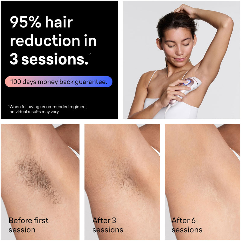 Braun Skin i·expert PL7243 IPL Hair Removal Device