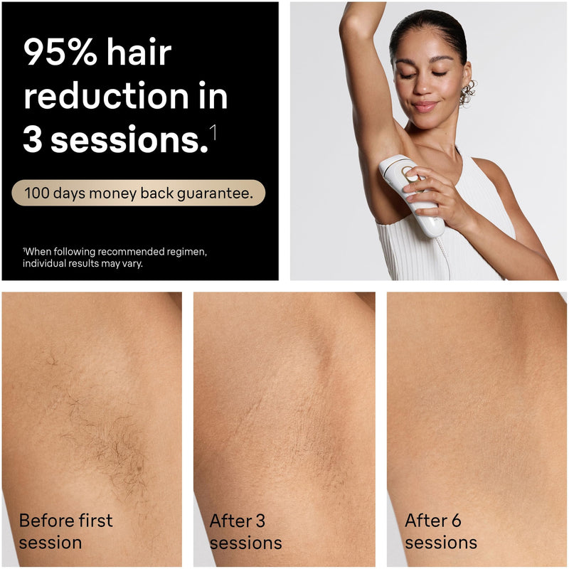 Braun Silk·expert Pro 5 PL5157 IPL Hair Removal Device