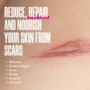 Zax's - Scar Fading Cream 28g - Limolin 