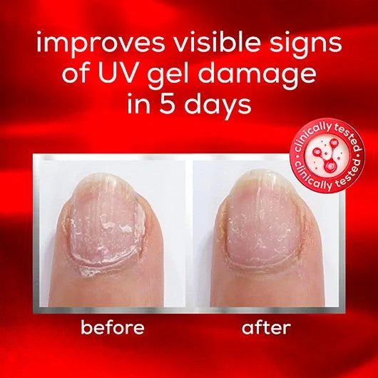 essie treatment - to the rescue nail repair (13.5ml) Beauty & Personal Care