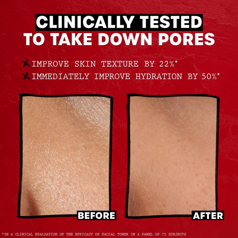 Thayers - Witch Hazel Rose Petal 355ml Beauty & Personal Care