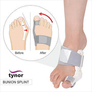 Tynor - BUNION SPLINT - UNIVERSAL Health & Wellness